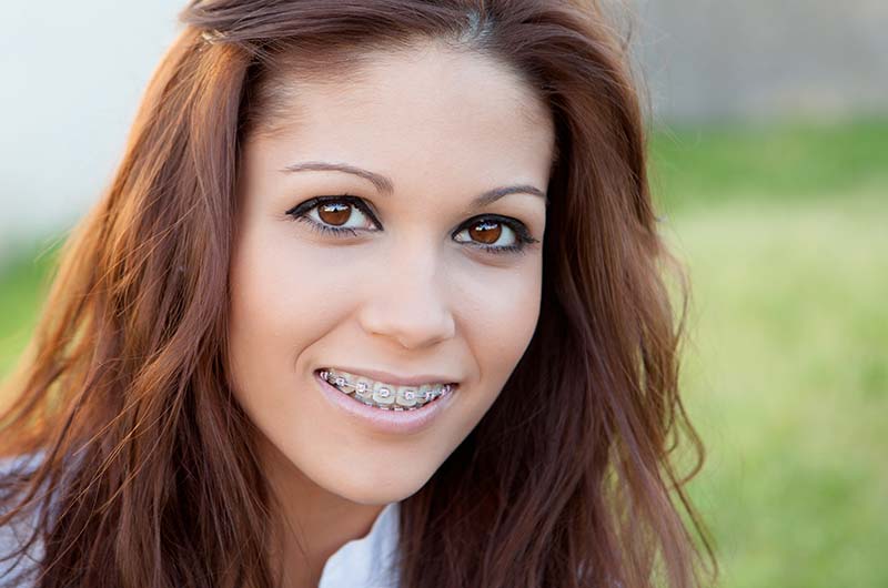braces-child